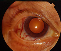 redeye2.jpg (17599 ֽ)